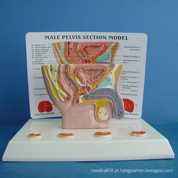 Modelo de demonstração anatômica médica genital feminina